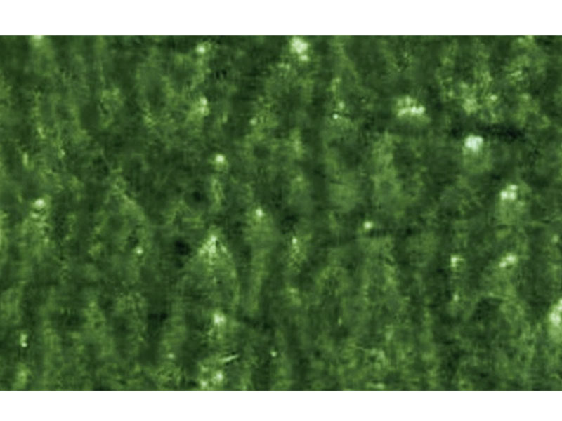 Flexo-Printing-Defects-of-Mottled Image عيوب الطباعة الفلكسوغرافية للصورة المرقطة